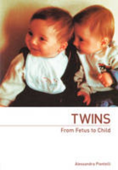 Picture of Twins  From fetus to child