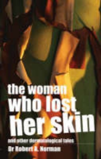 Picture of Woman Who Lost Her Skin