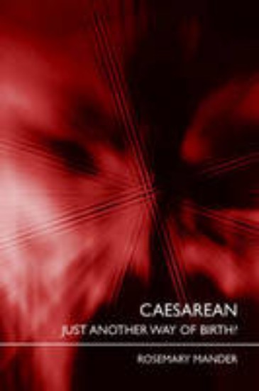 Picture of Caesarean Just another way of Birth?