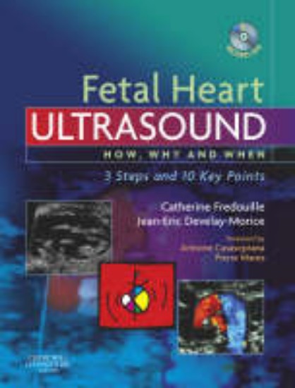 Picture of Fetal Heart Ultrasound: How, Why and When