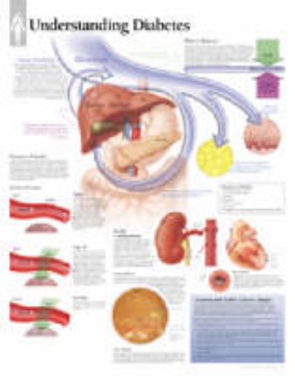 Picture of Anatomical Wall Chart - Understanding Diabetes