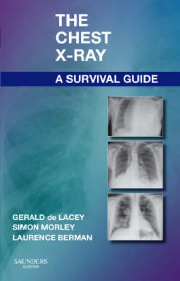 Picture of Chest X-Ray:survival guide