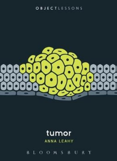 Picture of Tumor