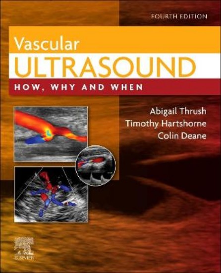 Picture of Vascular Ultrasound: How, Why and When 4ed