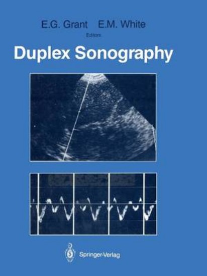 Picture of Duplex Sonography